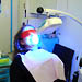 Светлинно избелване на зъби с LED лампа - STOMATOLOGBG.Net